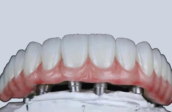 Welcome to Napol Dental & Implant Clinic